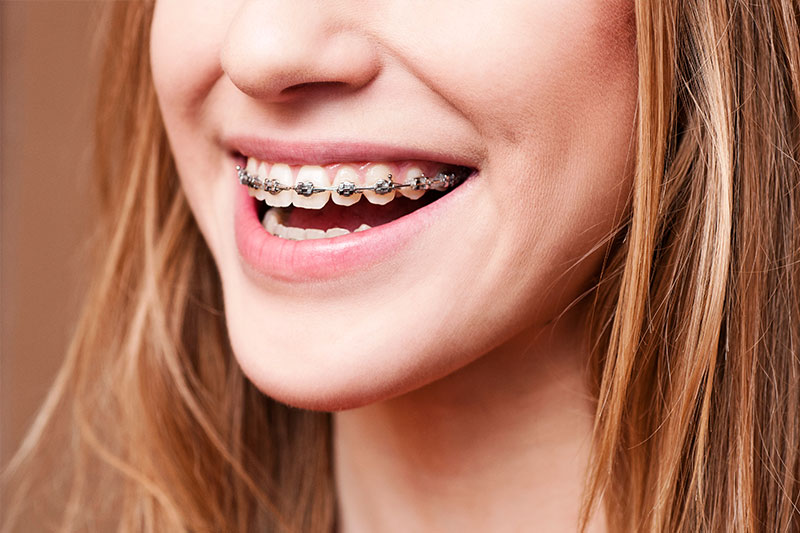 Columbia Orthodontics